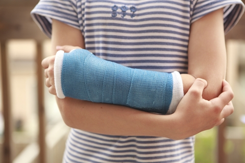 How to stop your arm from itching in a cast The Do S And Don Ts Of Cast Care