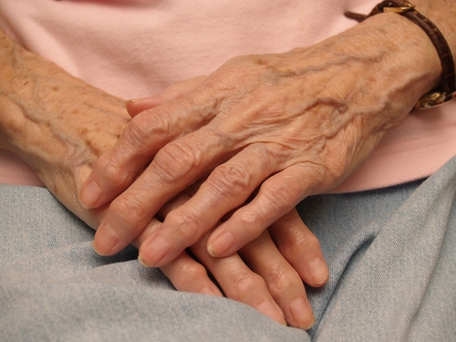 Age and gender can be risk factors for arthritis.