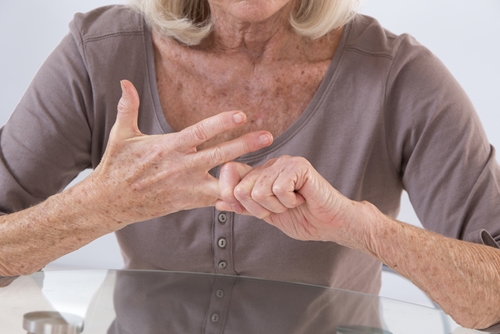 Arthritis in the hands in a painful condition.
