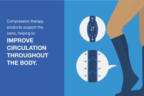 Illustration of how compression therapy support veins.