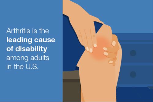 Arthritis is the leading cause of disability among adults in the U.S.